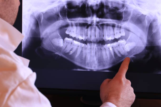 Best Dentist for Tooth Abscess  in Dovesville, SC